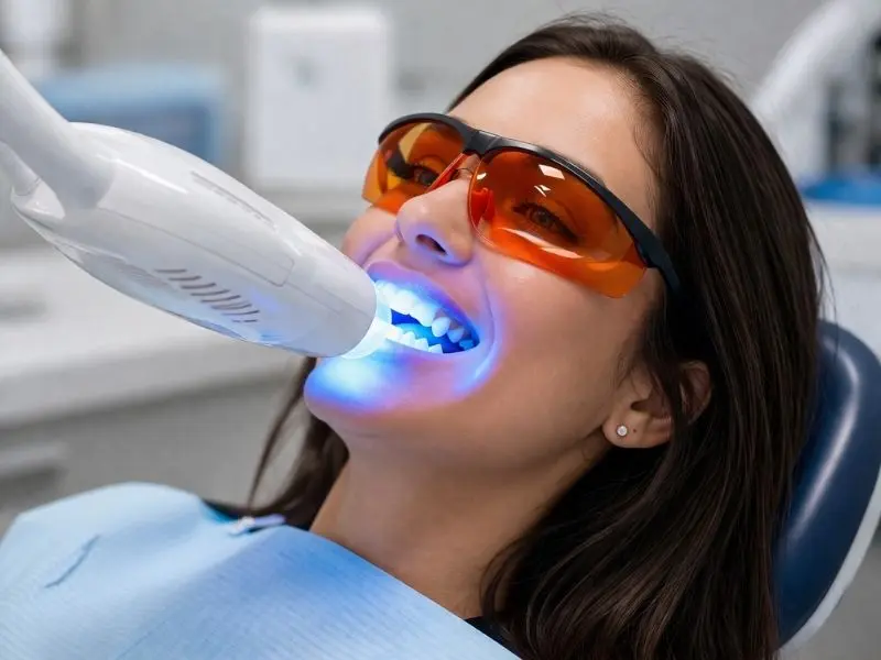 Blanqueamiento dental en clinica Horta-Guinardó Institut Dental Torres Ballart