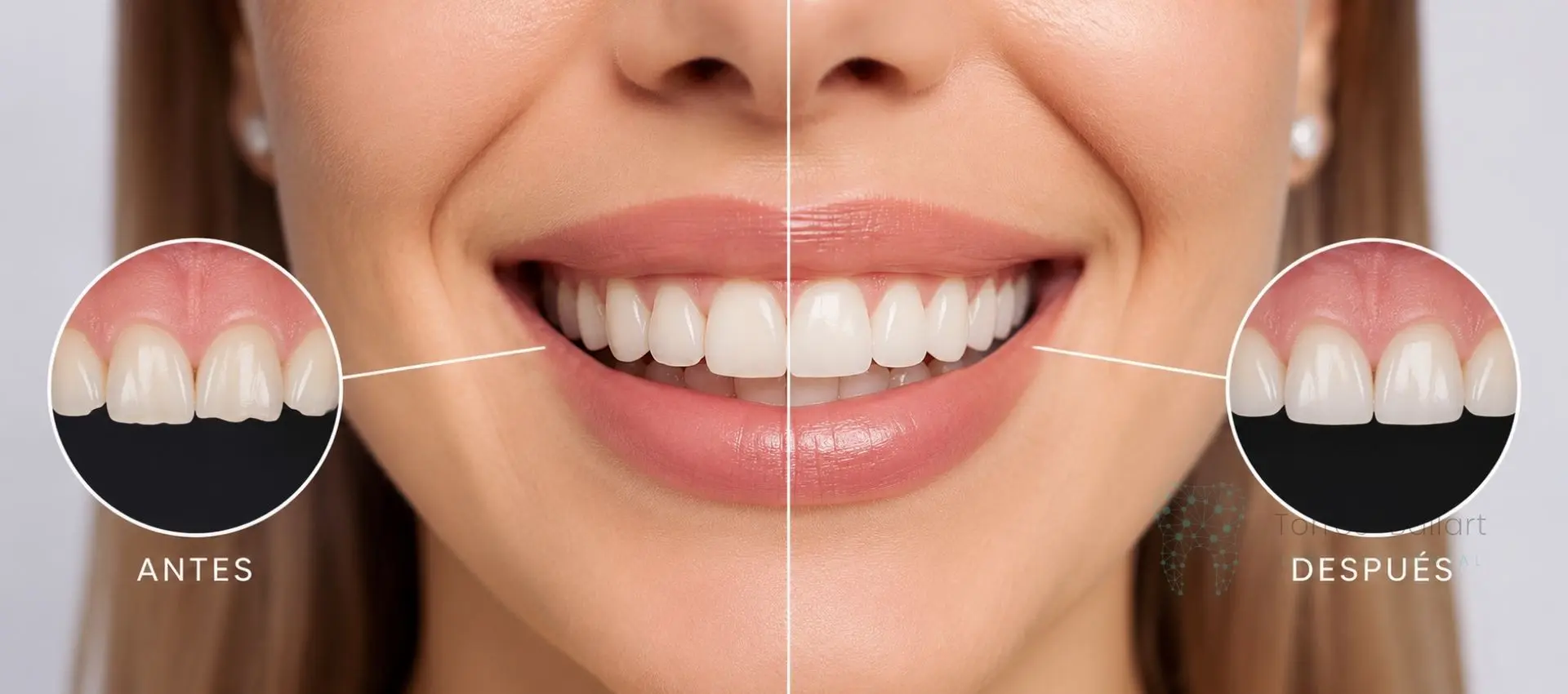 Bordes dentales irregulares en Horta-Guinardó Institut Dental Torres Ballart
