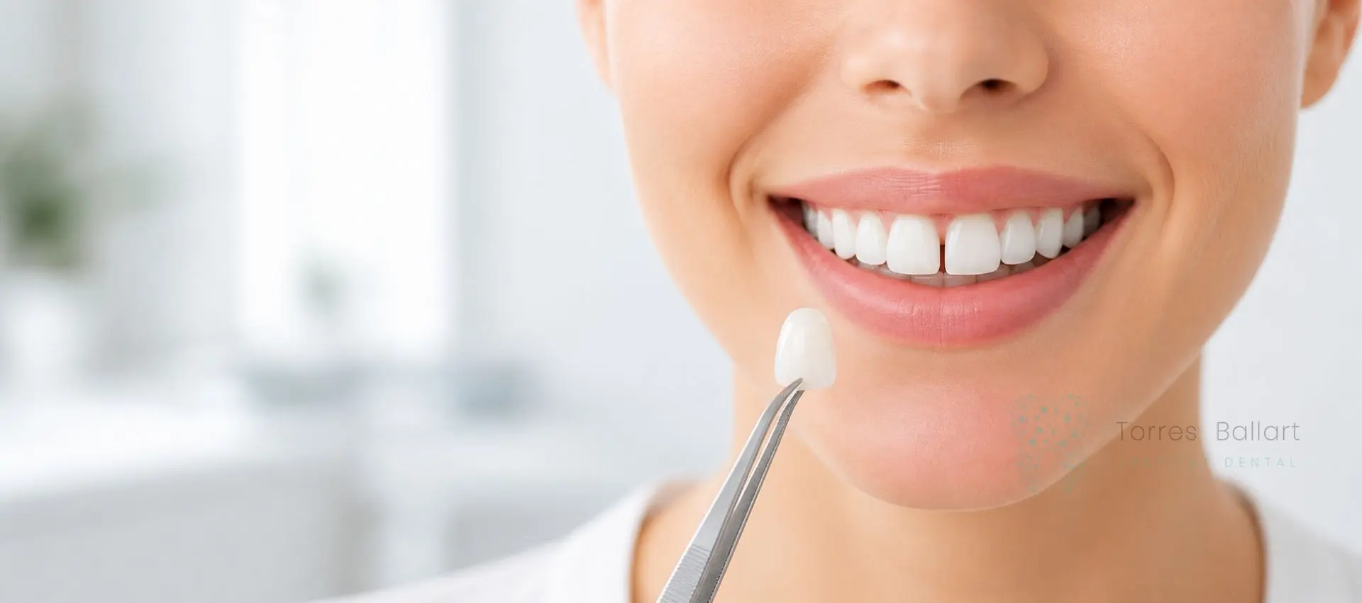 Carillas de porcelana para cerrar diastemas en Institu Dental Torres Ballart (Barcelona)