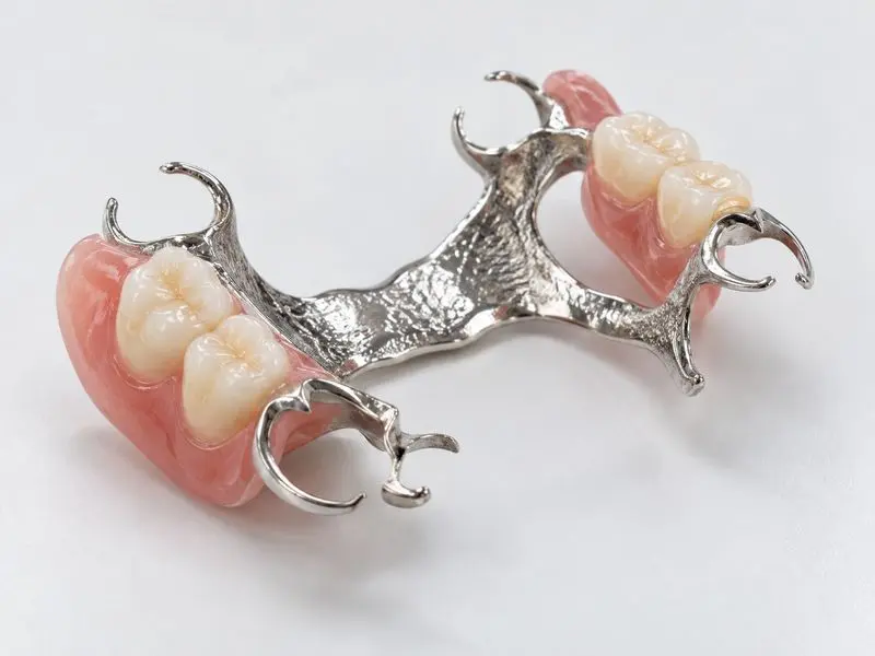 Prótesis parcial esquelética en Horta Guinardó (Barcelona) Institut Dental Torres Ballart